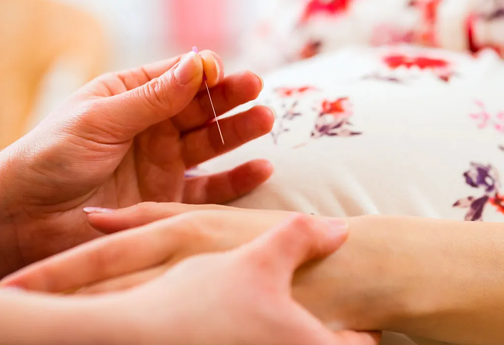 Acupuncture