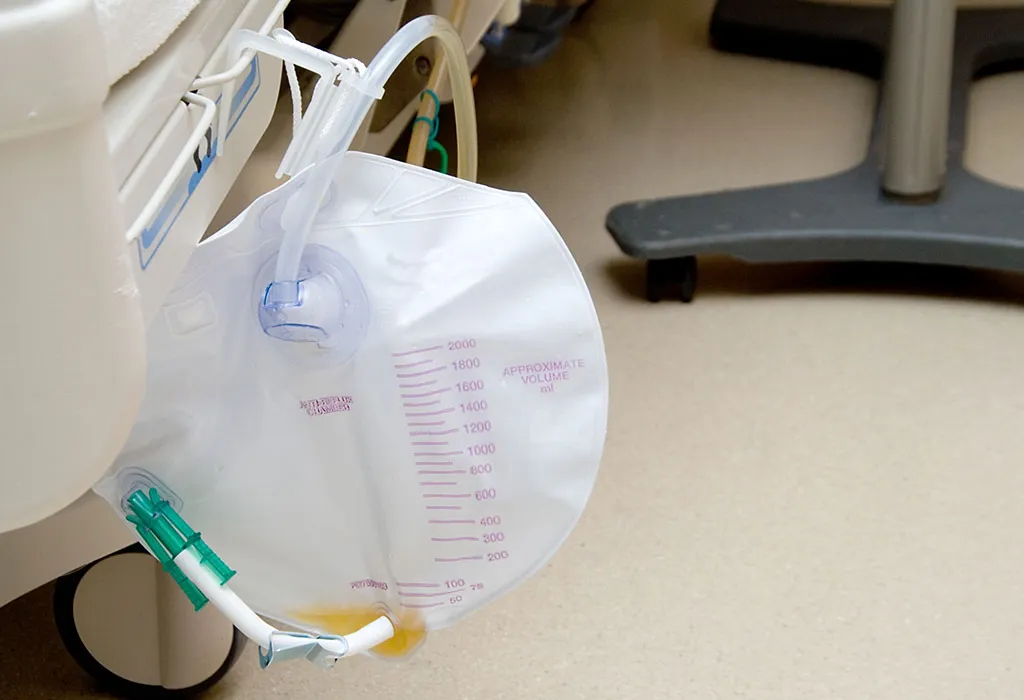 Postpartum Hemorrhage Treatment