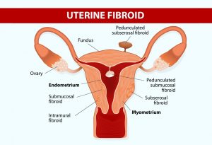 Normal Uterus Size Chart