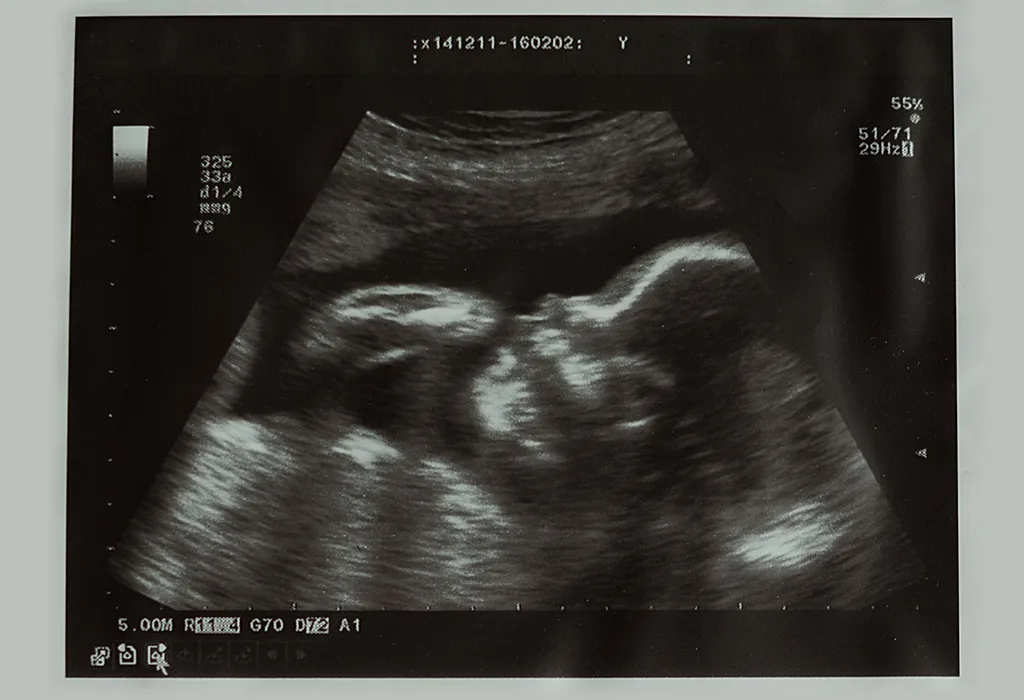 24 Weeks Ultrasound and Other Tests