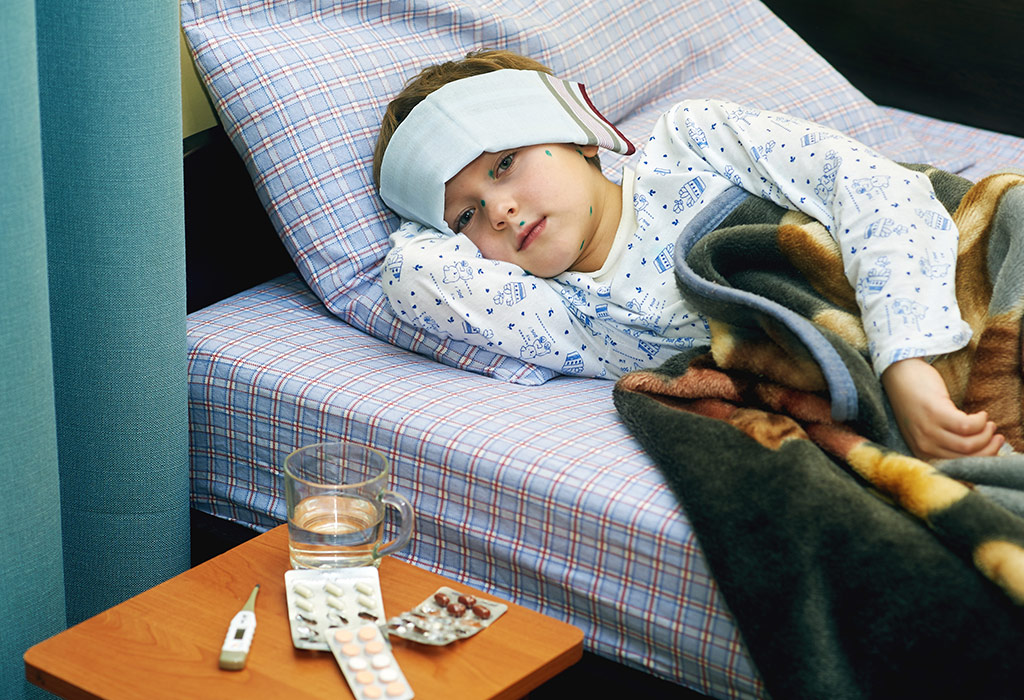 Symptoms of Chickenpox