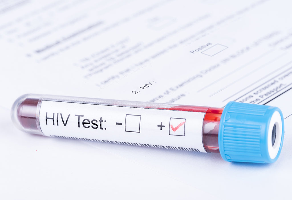 How Is HIV Testing Done?