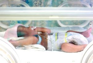 Premature newborn with low birth weight