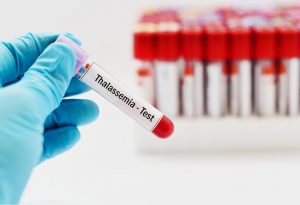 Thalassemia blood test