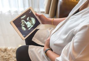 A pregnant woman holding an ultrasound scan