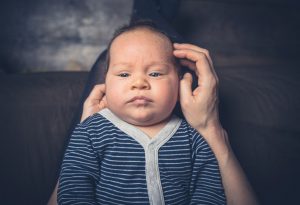 Causes of Cradle Cap in Infants