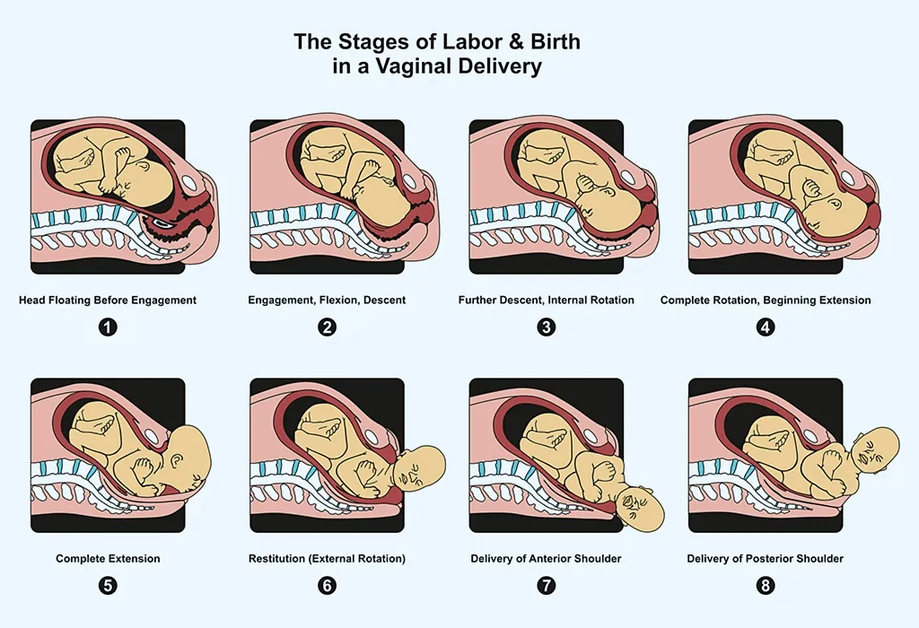 Stages of labor and Birth in Natural Childbirth