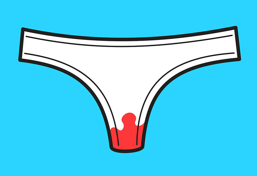 How Is Implantation Bleeding Mistaken for Periods?
