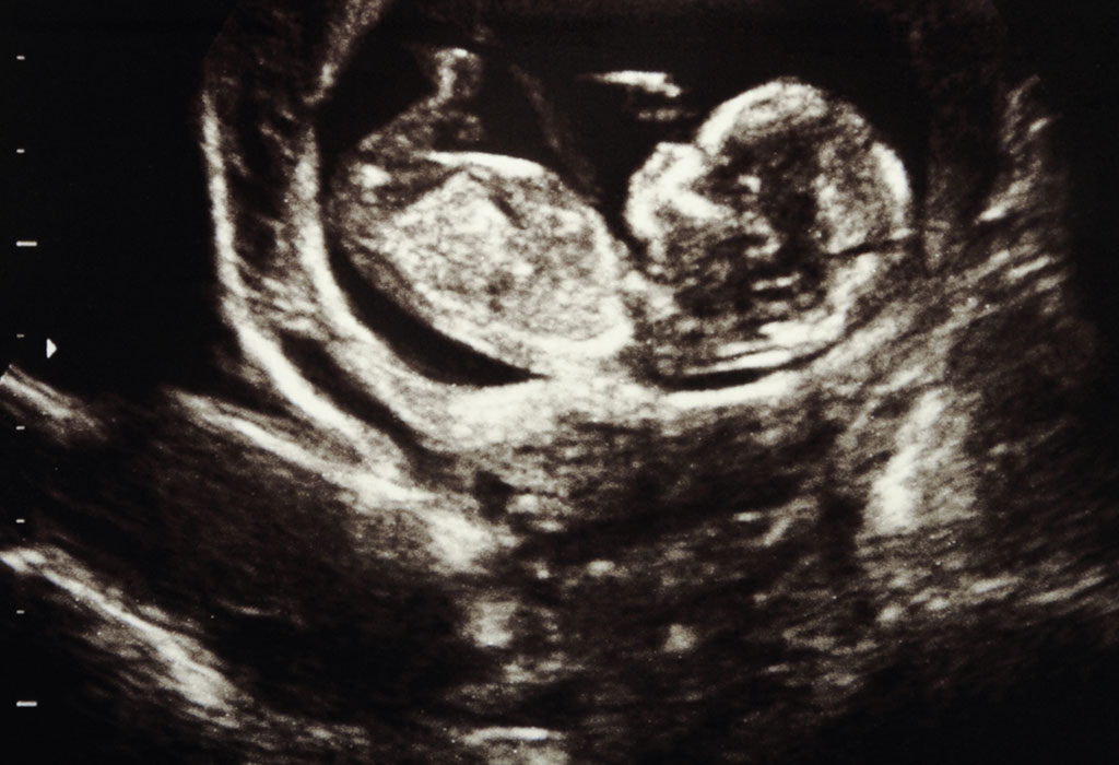 Examining the baby by conducting an ultrasound scan during pregnancy
