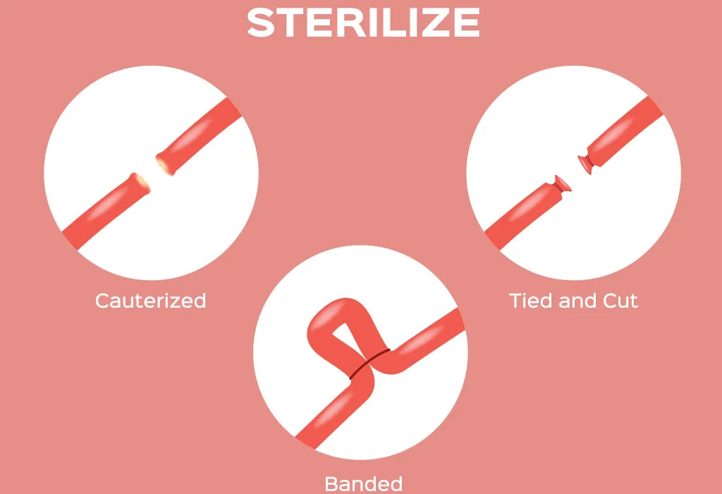 What Happens During the Procedure?