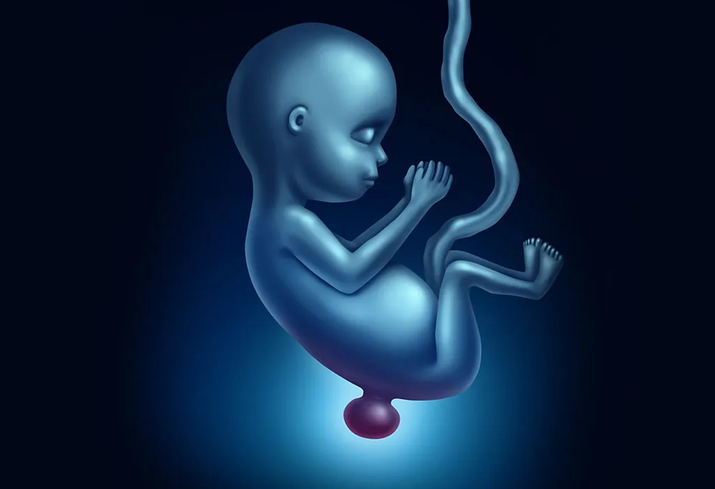 Spina bifida birth defect