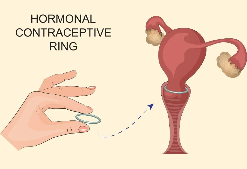 How the vaginal ring works