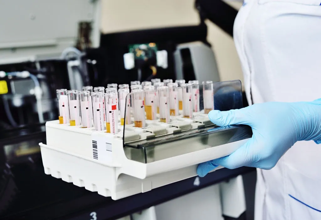 Diagnostic test for hematuria