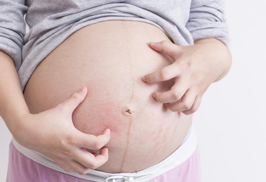 A pregnant woman scratching her belly