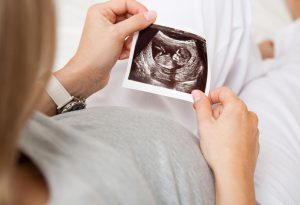 A pregnant woman holding ultrasound photo