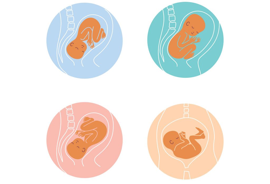 Different positions of the baby in the womb