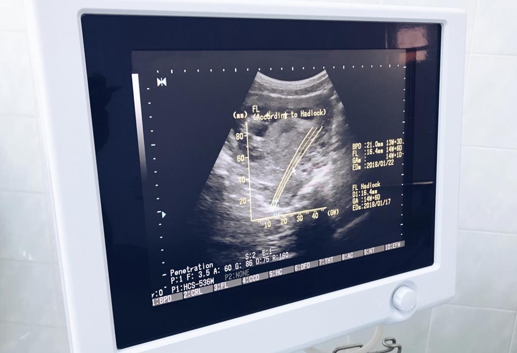 14 weeks pregnant ultrasound