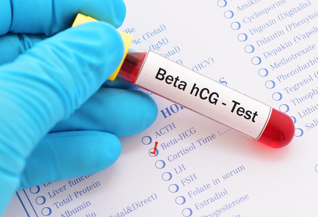 HCG TEST