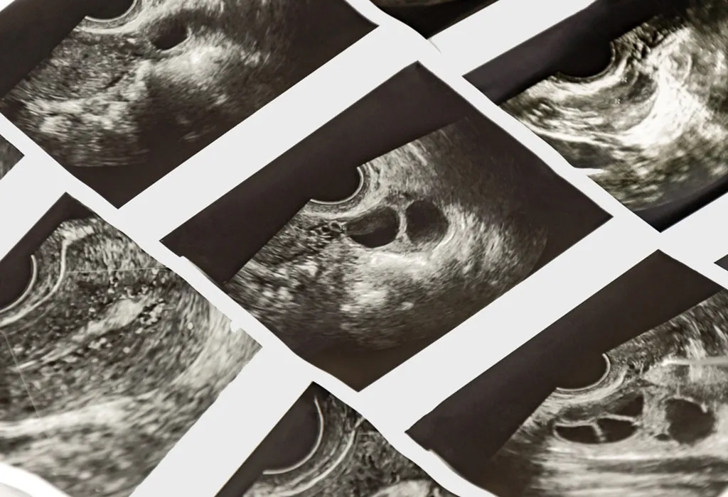 Images of a follicular scan