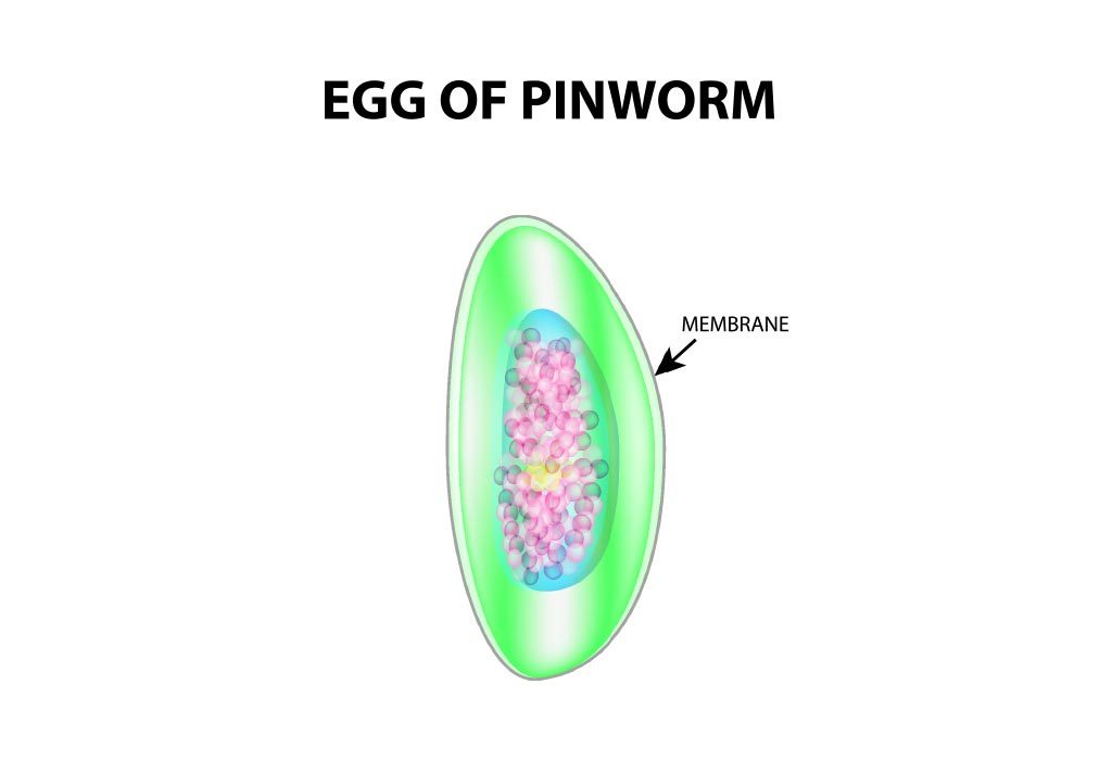 pinworms in kids poop