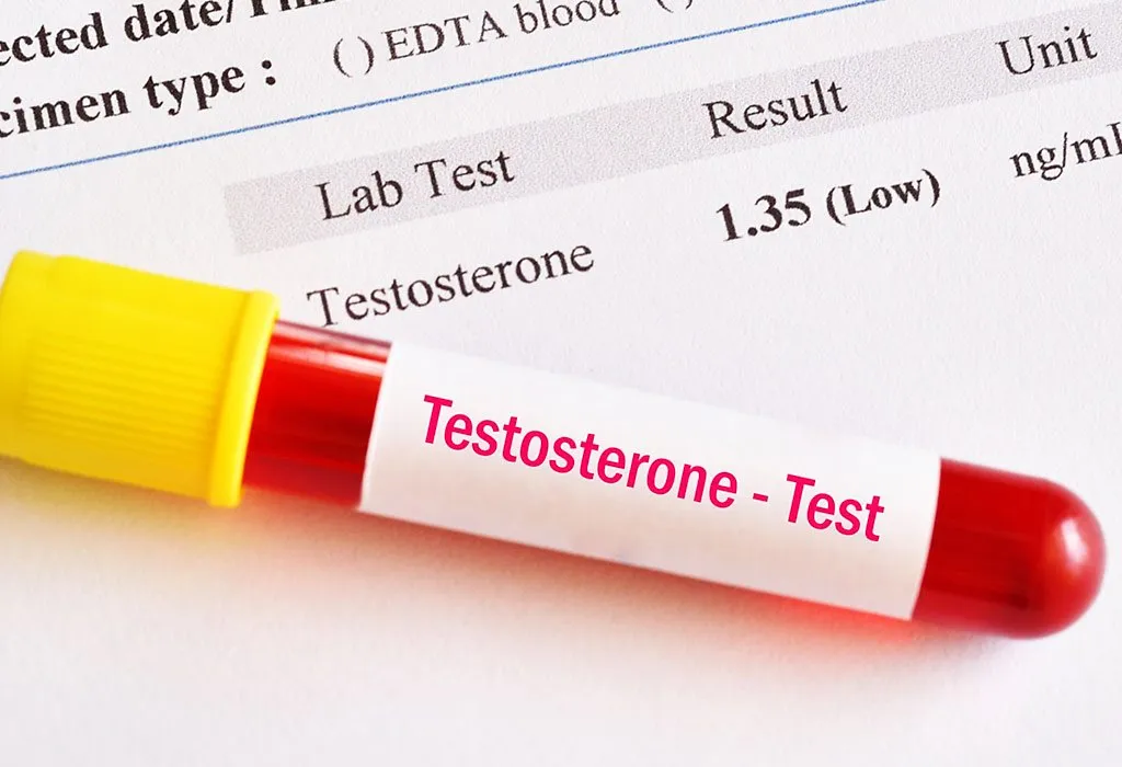 DECREASED TESTOSTERONE