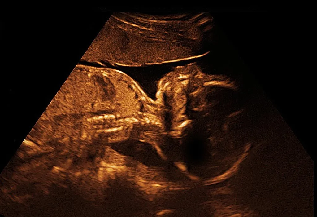 A baby's ultrasound