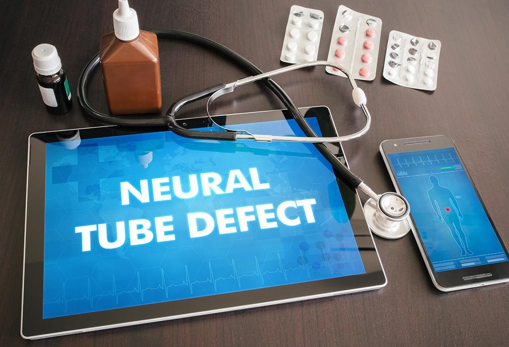 NEURAL TUBE DEFECTS