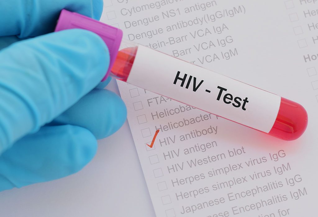 A positive HIV test