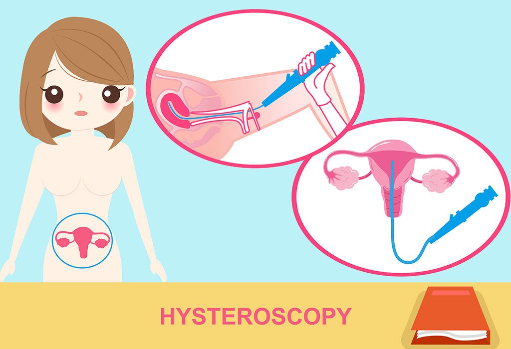 Can i still have a hysteroscopy while on my period