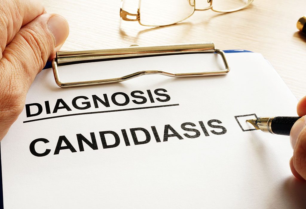 Candidiasis diagnosed