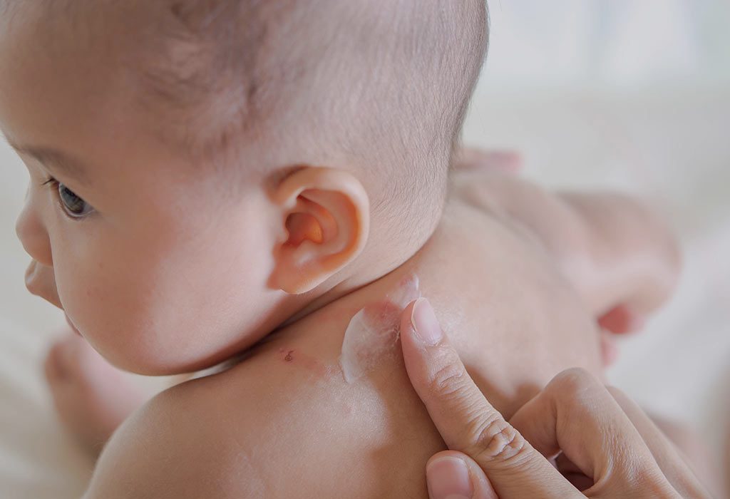 Applying cream for baby's skin problems