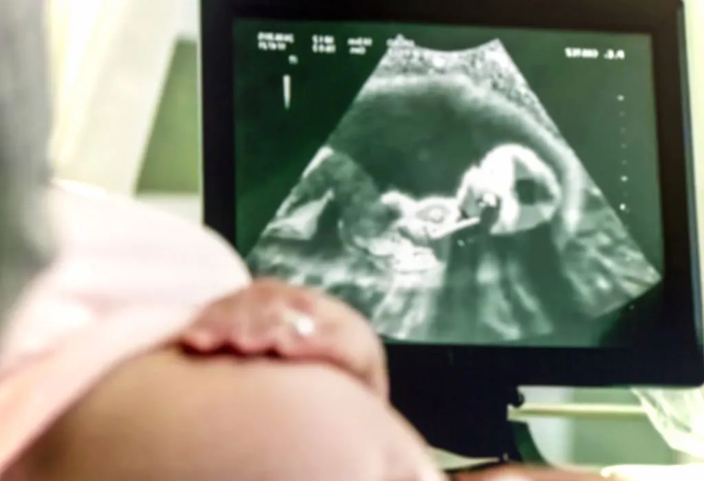 A doctor doing an ultrasound scan of a pregnant woman