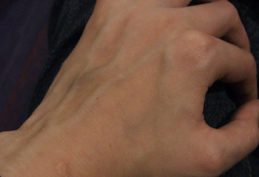 Do You Have Veiny Hands 7 Causes Why Veins Pop Out