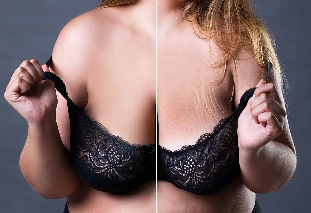 Post-Pregnancy Breasts: The Good, The Bad and The Saggy - Is This