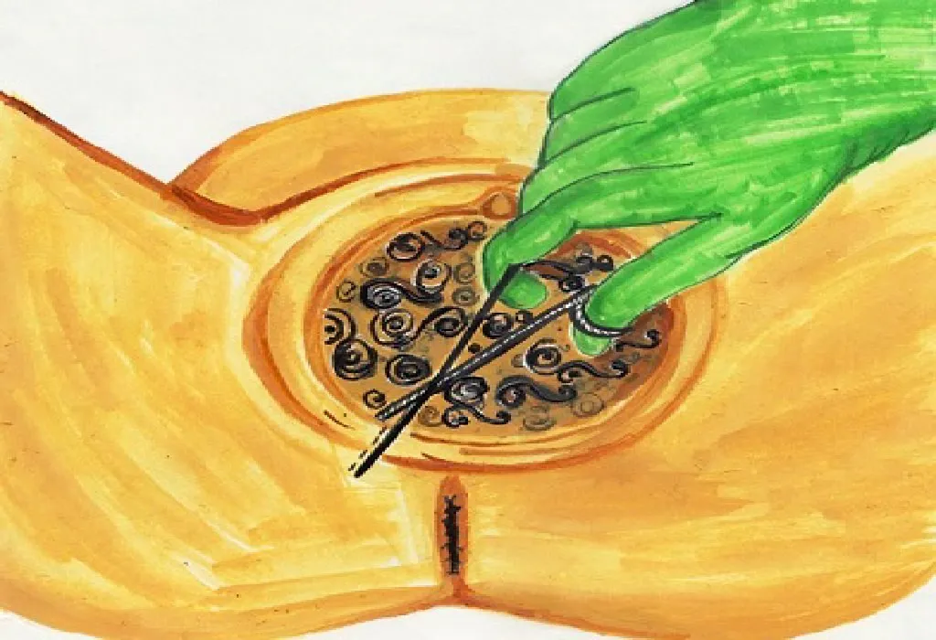 Vaginal Birth