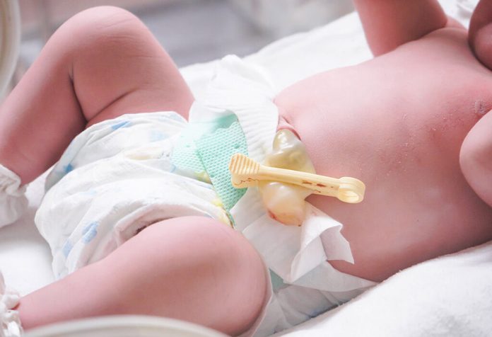 Newborn Umbilical Cord Care: Everything Parents Should Know