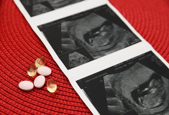 प्रसुतीपूर्व पूरक औषधे घ्या