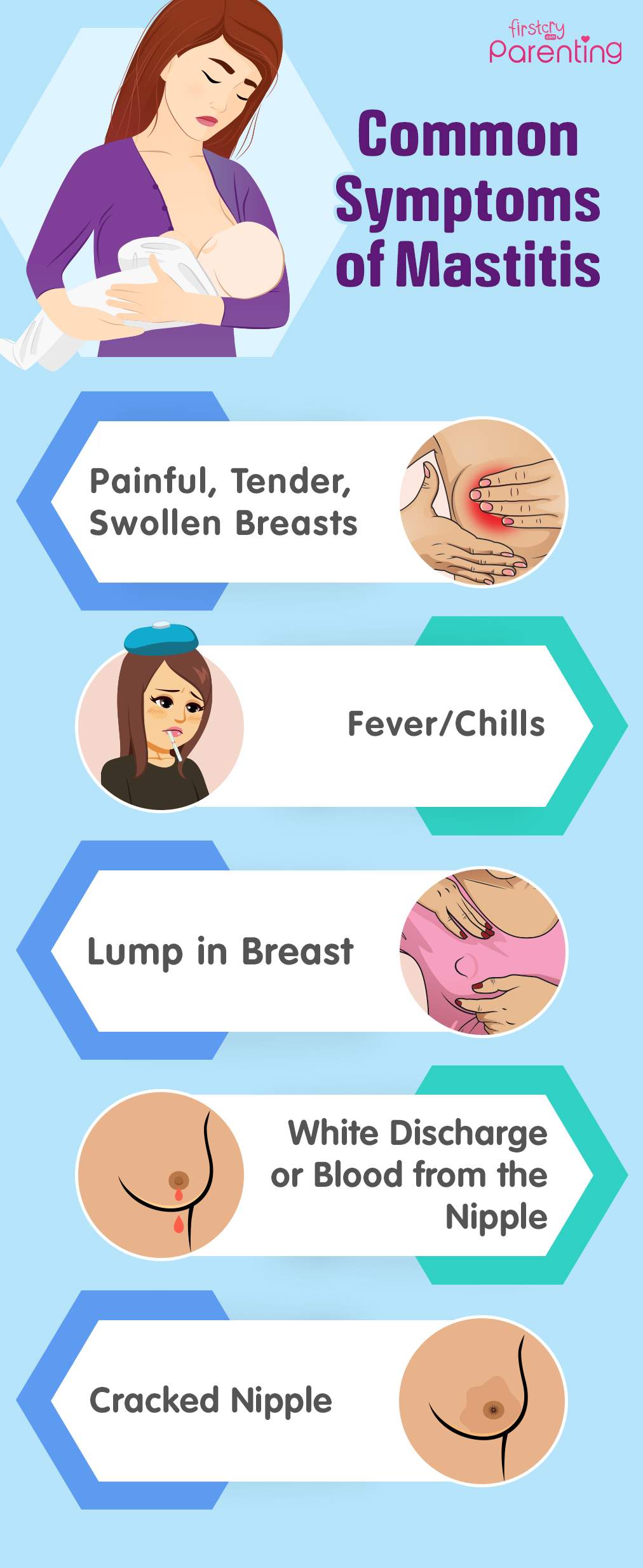 Mastitis: Causes, Symptoms, Treatment & Prevention