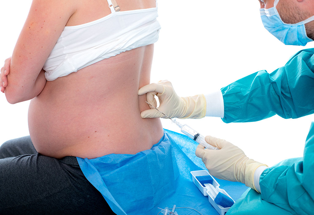 Epidural Injection For Childbirth Pain Relief