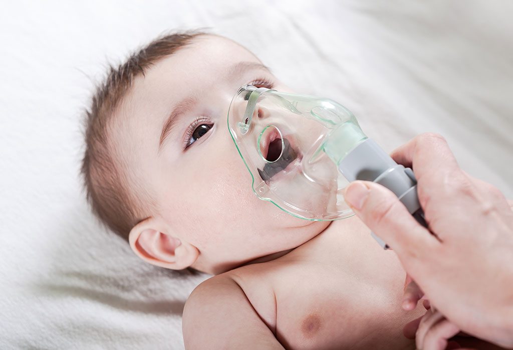 Croup in Babies: Causes, Symptoms, Treatment and More