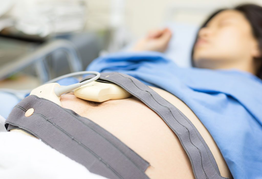 Placental Abruption (Abruptio Placentae) During Pregnancy