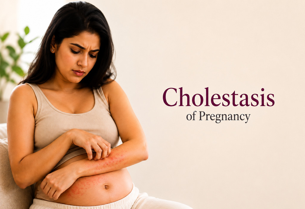 Cholestasis of Pregnancy: Signs, Symptoms, and Treatment Cholestasis of Pregnancy: Signs, Symptoms, and Treatment