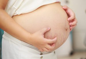 妊娠中の産科胆汁うっ滞の症状は何ですか？