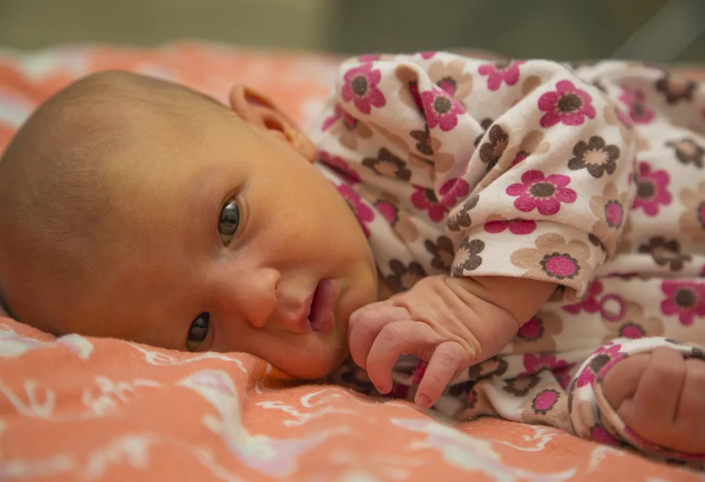 what is jaundice in premature babies