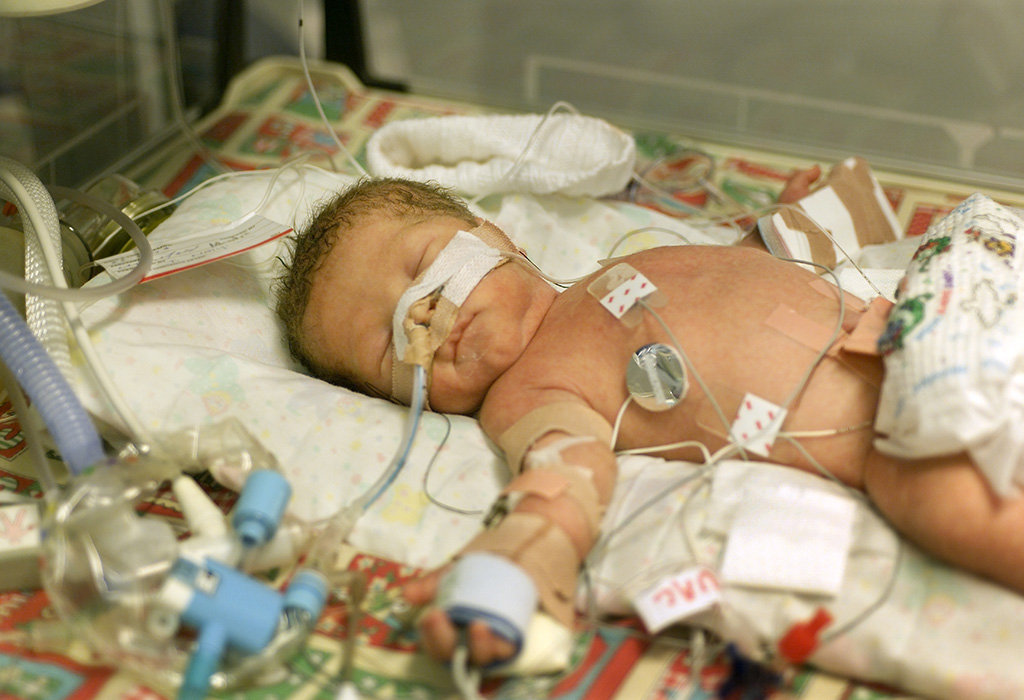 न्यूबॉर्न बेबी में हाइपोग्लाइसीमिया के कारण 