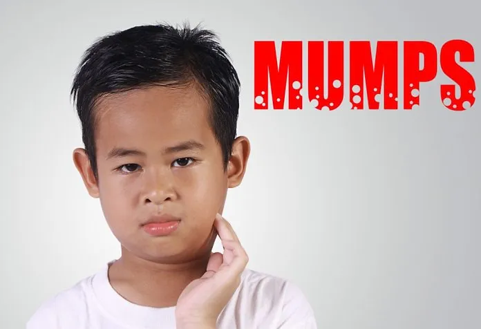 Mumps bei Kindern 