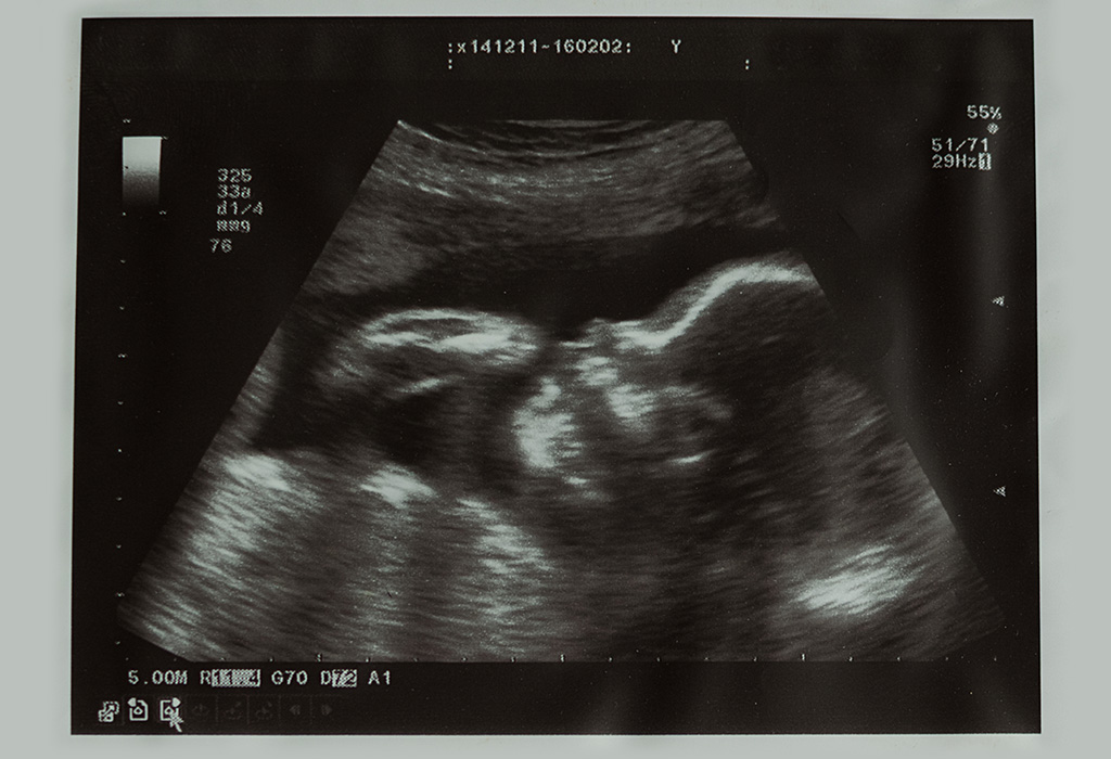 गर्भावस्था के 24वें सप्ताह में अल्ट्रासाउंड और अन्य परीक्षण
