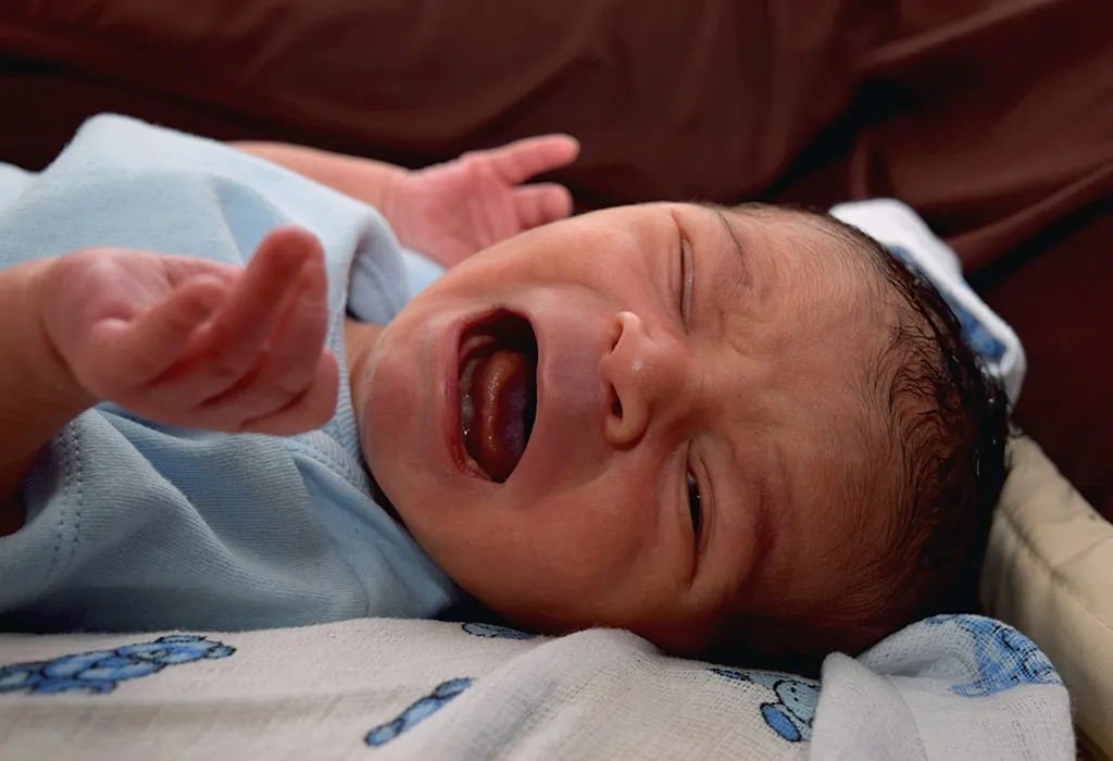 Symptoms of Tongue-Tie in Babies