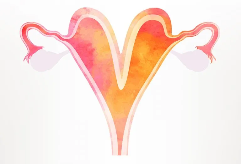 Bicornuate(Heart Shaped) Uterus