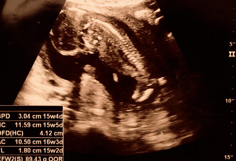 गर्भावस्था के 15वें सप्ताह का अल्ट्रासाउंड